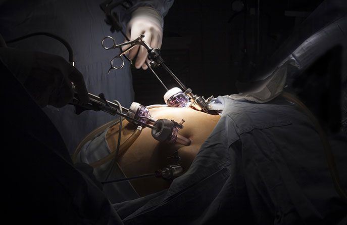 Medical Malpractice Attorneys Against Botched Gastric Bypass Surgery