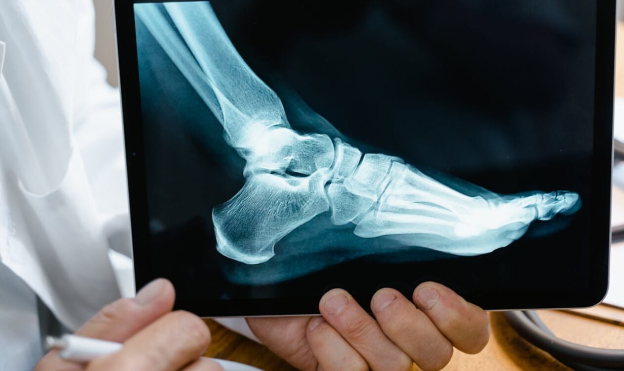 What Are Wrong Site Surgical Errors