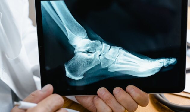 What Are Wrong Site Surgical Errors